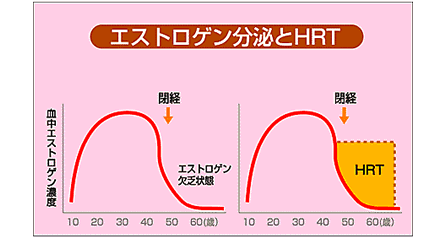 萎縮 性 腟炎